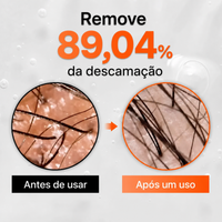 Exclusive BR